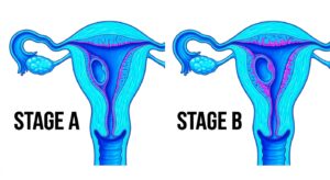 임신 주수별 자궁 변화를 나타내는 의학적 다이어그램